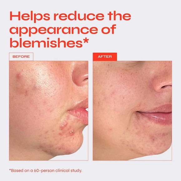 Brand New- Facile x Sephora Skincare Set ❤️✨ - Picture 6 of 13